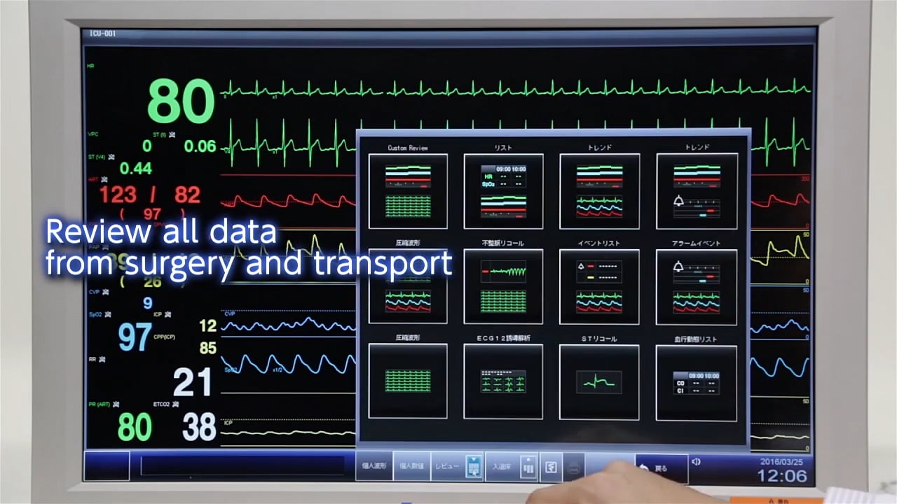 Lifescope PT Transport Monitor 2016 ASA